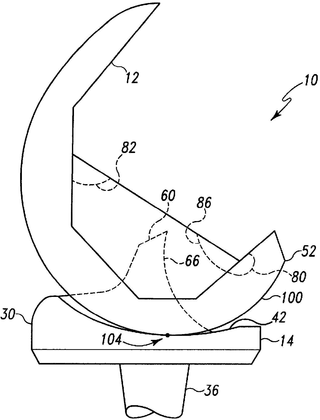 Posterior stabilized orthopaedic knee prosthesis having controlled condylar curvature