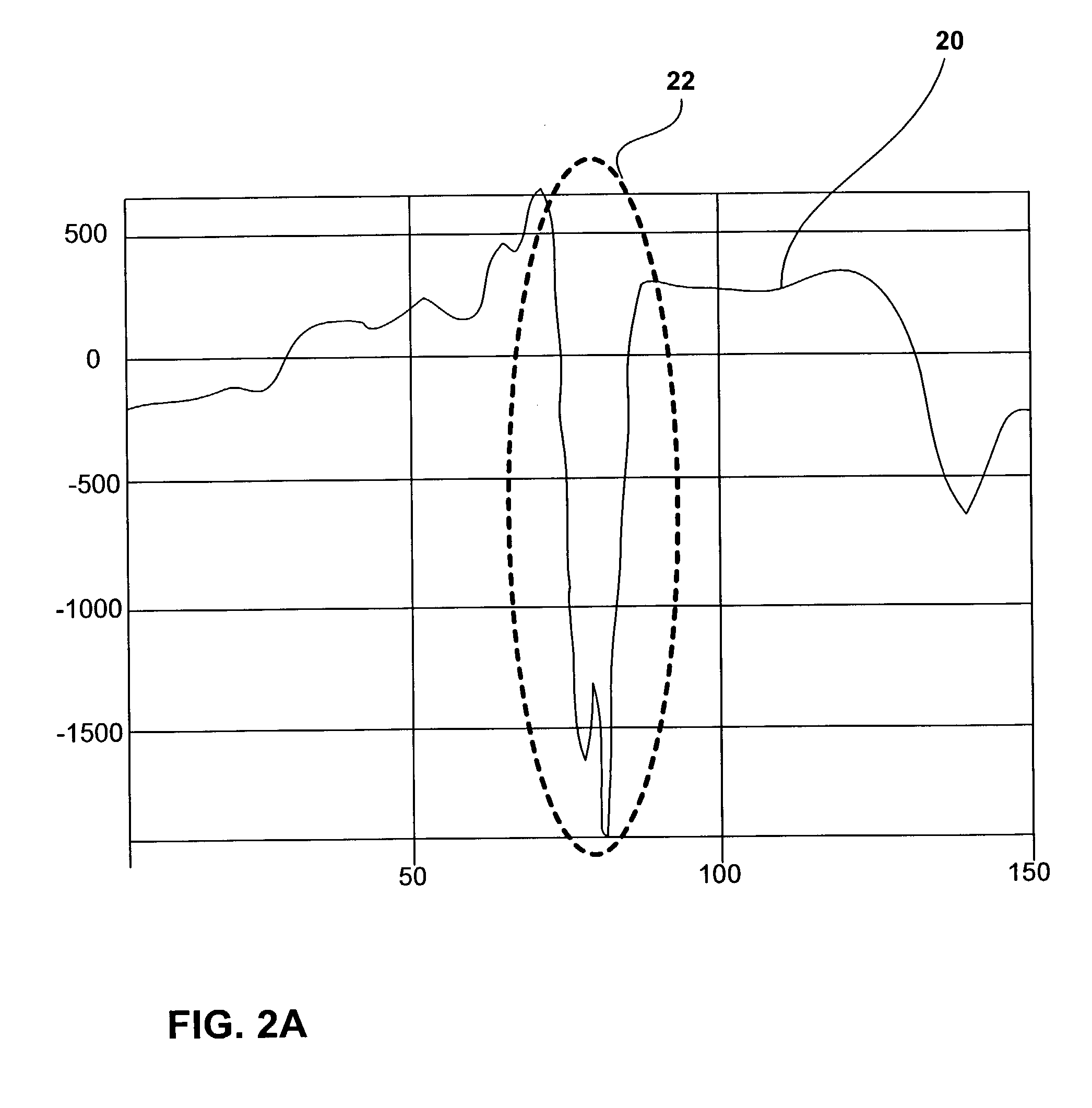 Biomedical signal analysis techniques using wavelets