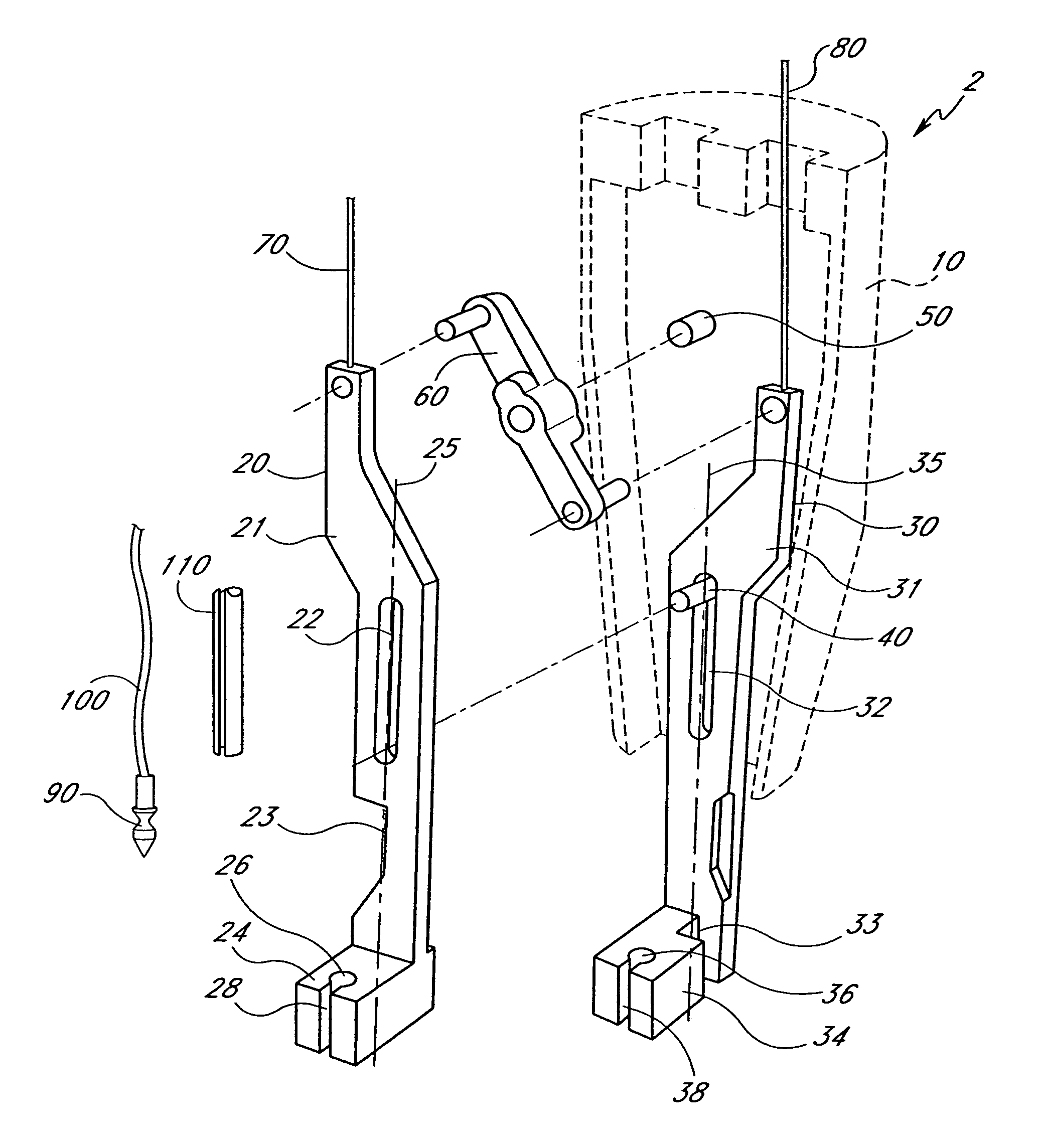 Suturing device