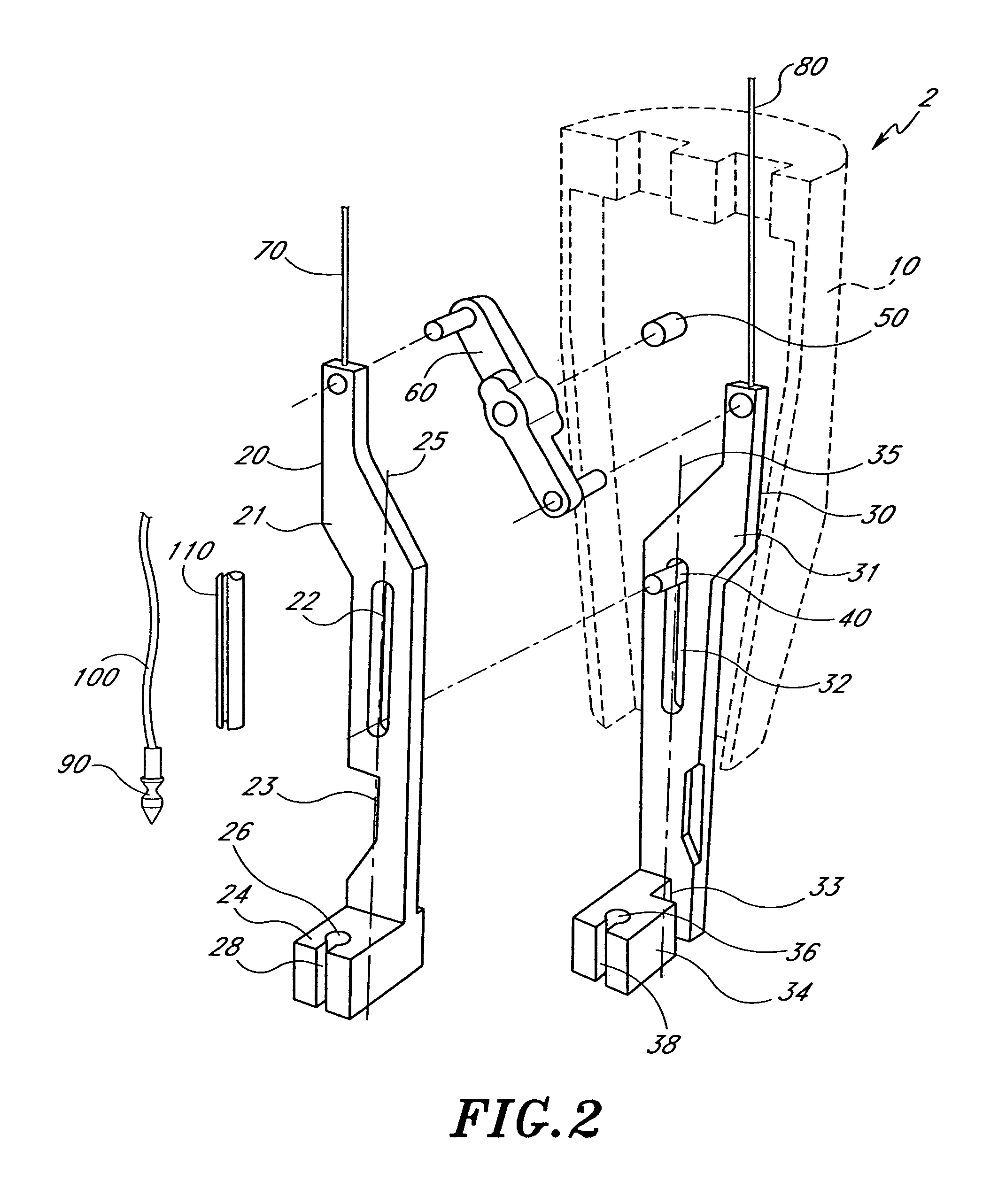 Suturing device