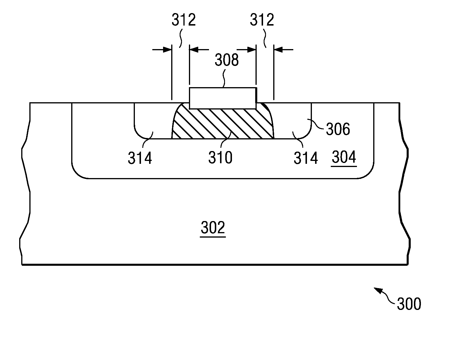 Versatile system for optimizing current gain in bipolar transistor structures