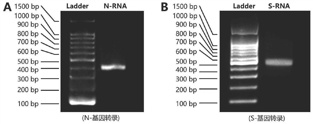 A kind of probe and primer, kit, detection method and application for detecting new coronavirus sars-cov-2