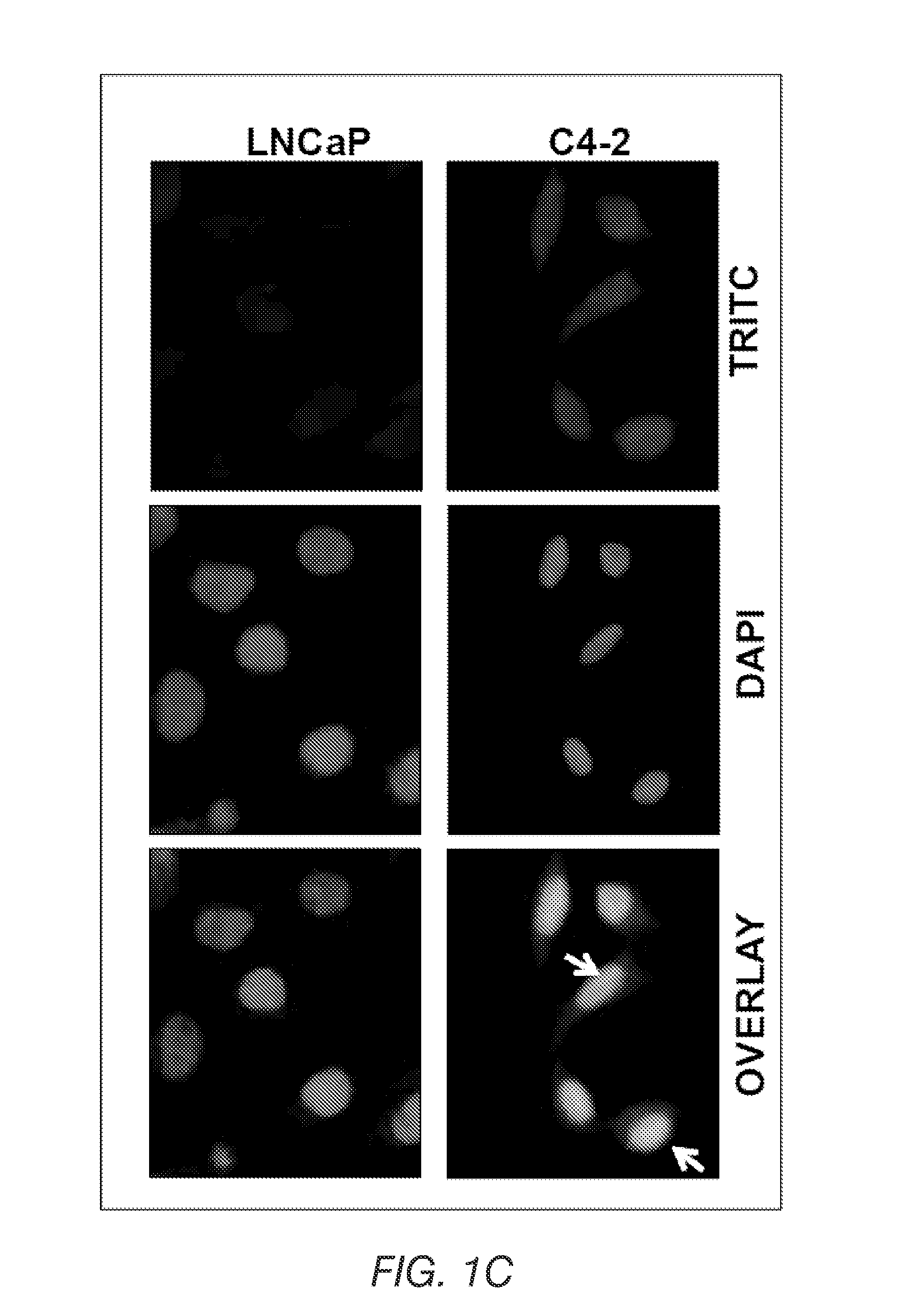 Methods and compositions for the diagnosis, classification, and treatment of cancer