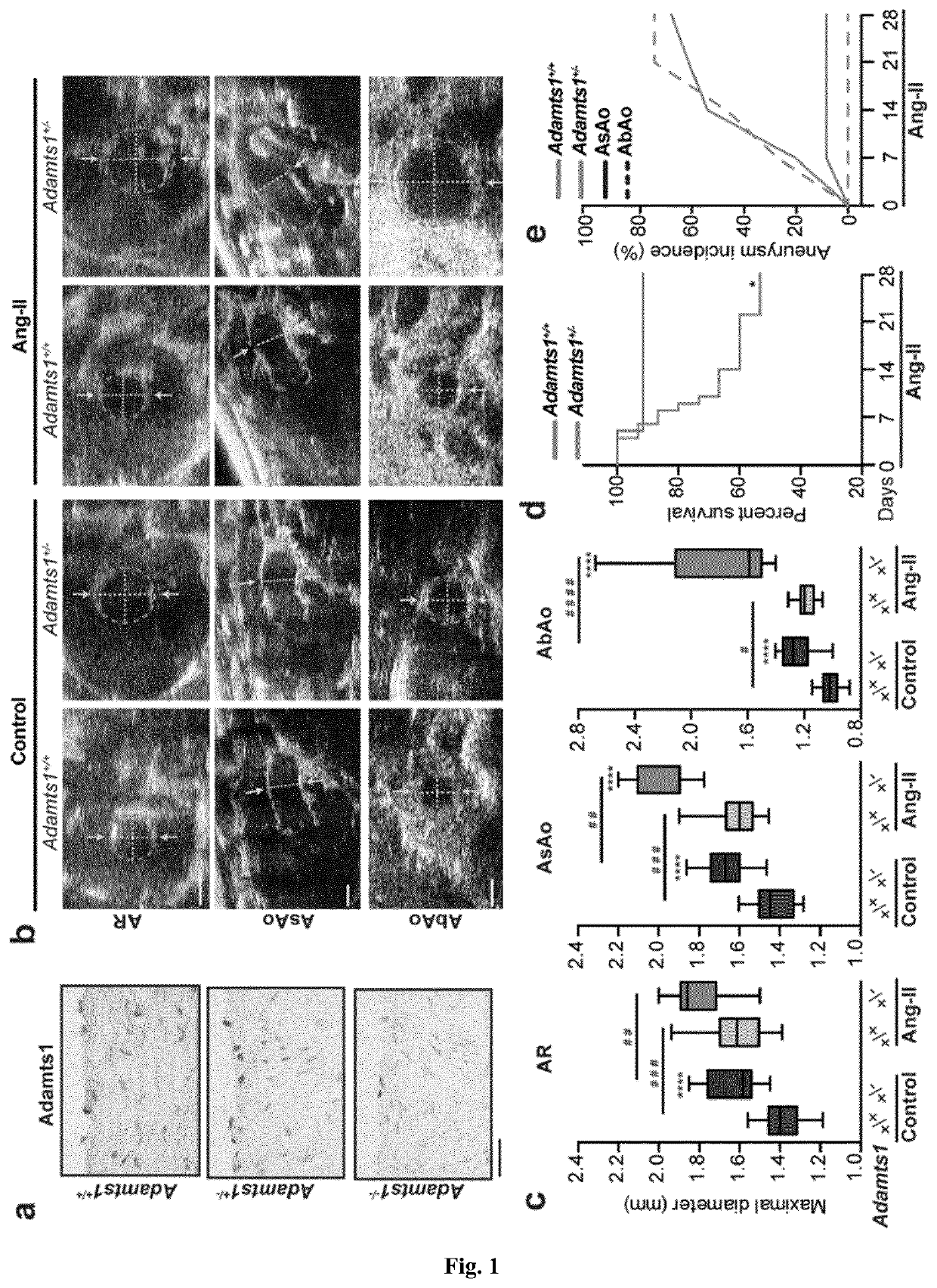 In vitro method for identifying thoracic aortic aneurysms (TAA) in a subject