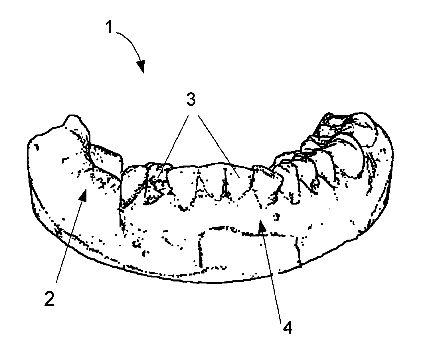 Method for creating a personalized digital planning file for simulation of dental implant placement