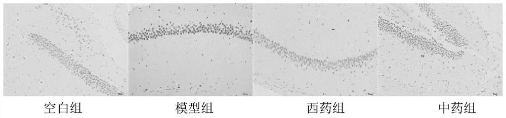 A traditional Chinese medicine composition for treating Parkinson's disease and its preparation method and application