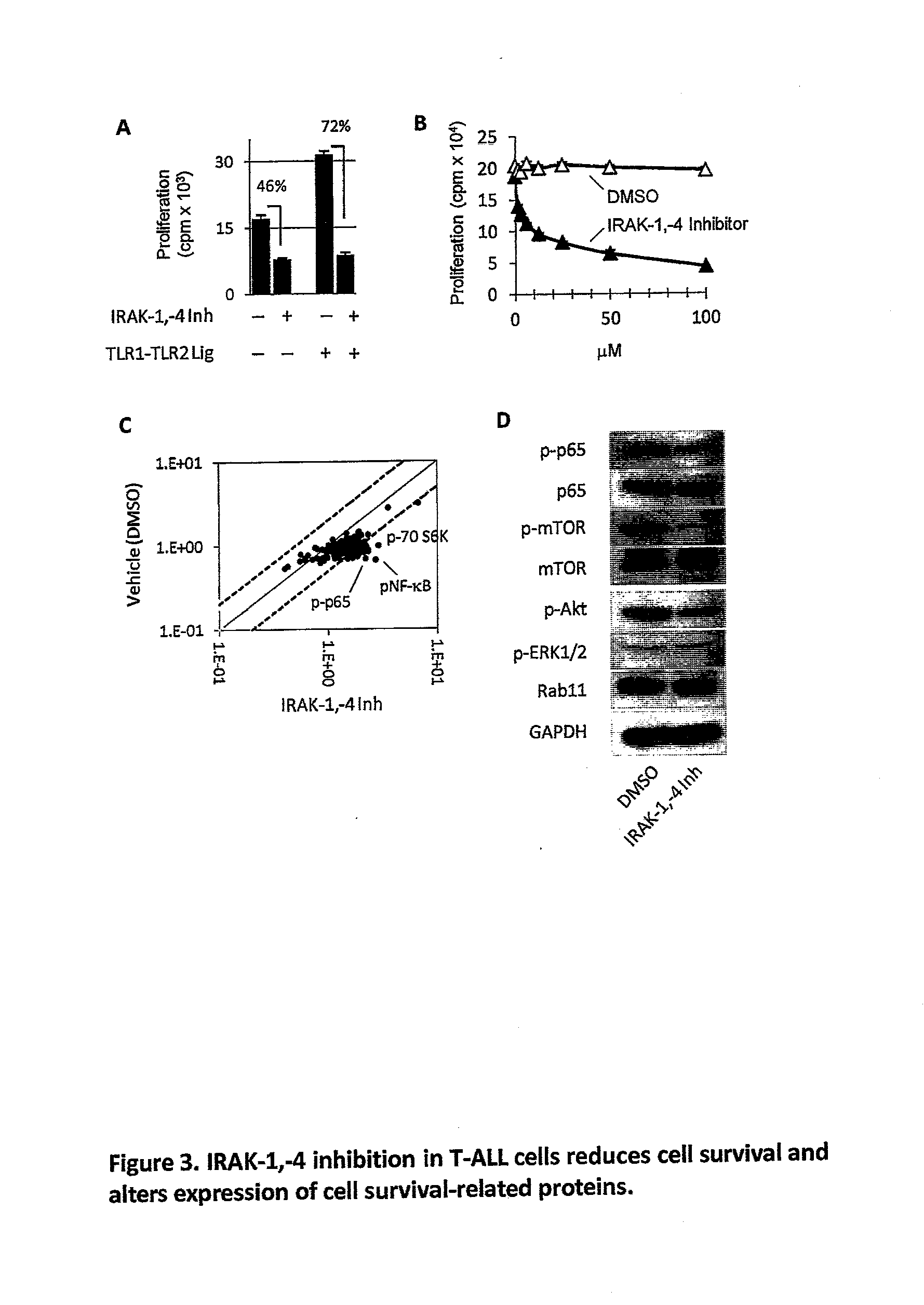 Total and Phosphorylated IL-1 Receptor-Associated Kinase-1 and IL-1 Receptor-Associated Kinase-4 as a Biomarker for Cancer Progression and Chemotherapy Resistance