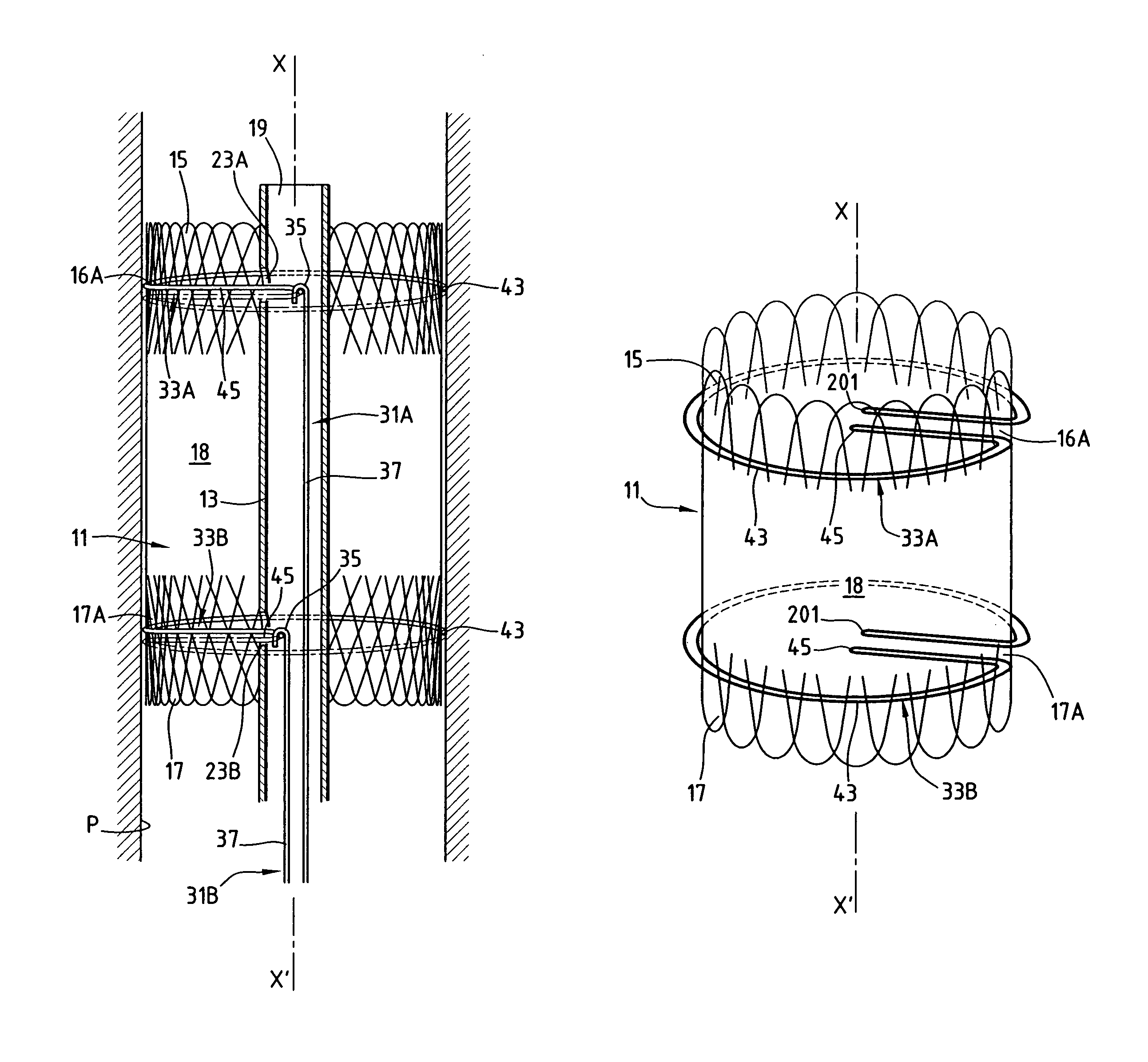 Device for treating a blood circulation canal and process for preparing this device