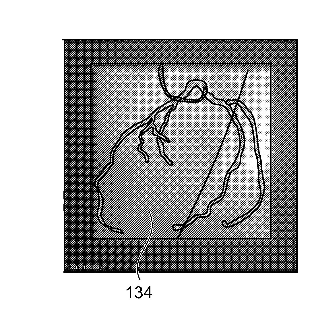 3d-originated cardiac roadmapping