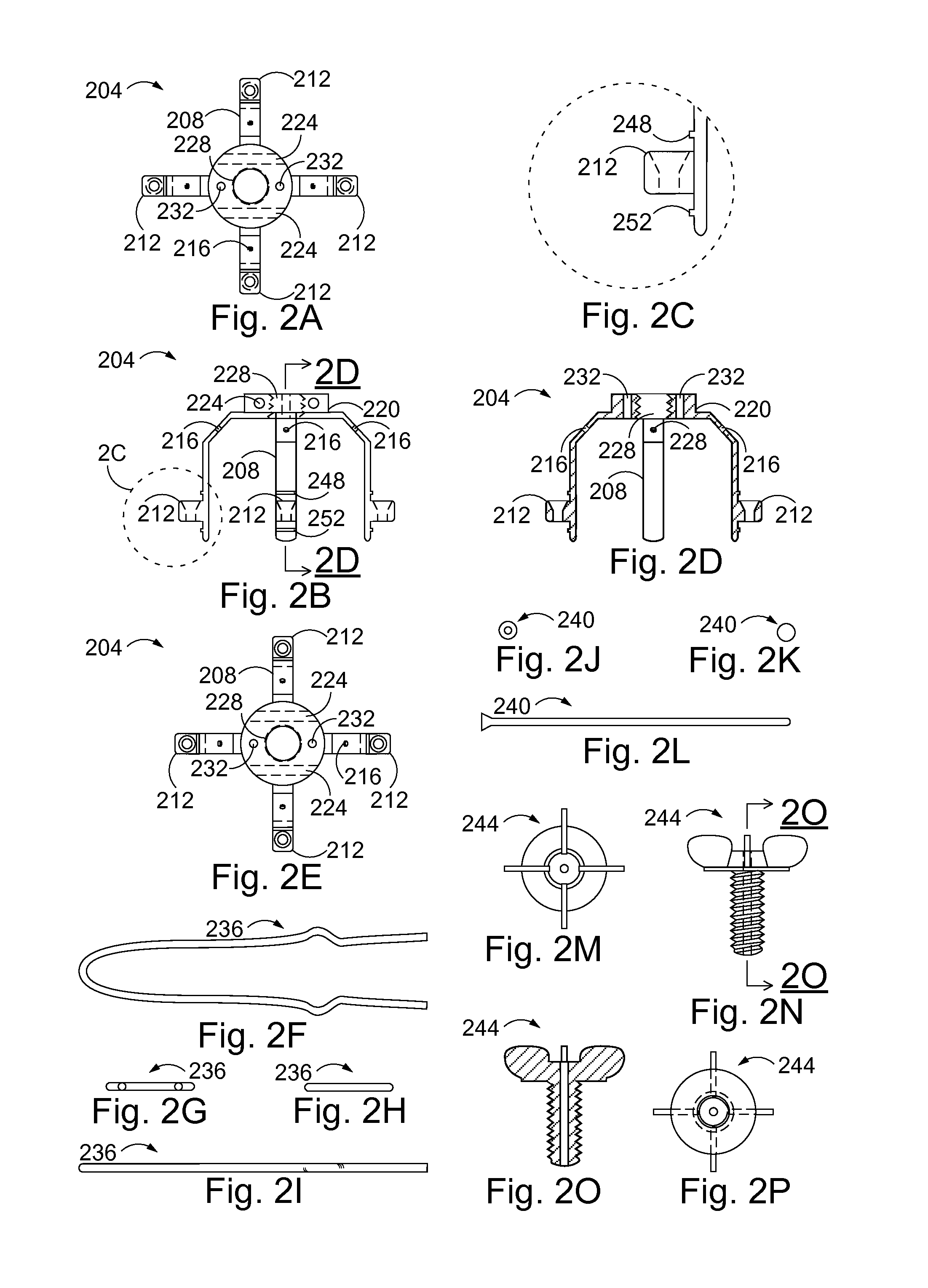 Method and System for Modular Hip Resurfacing