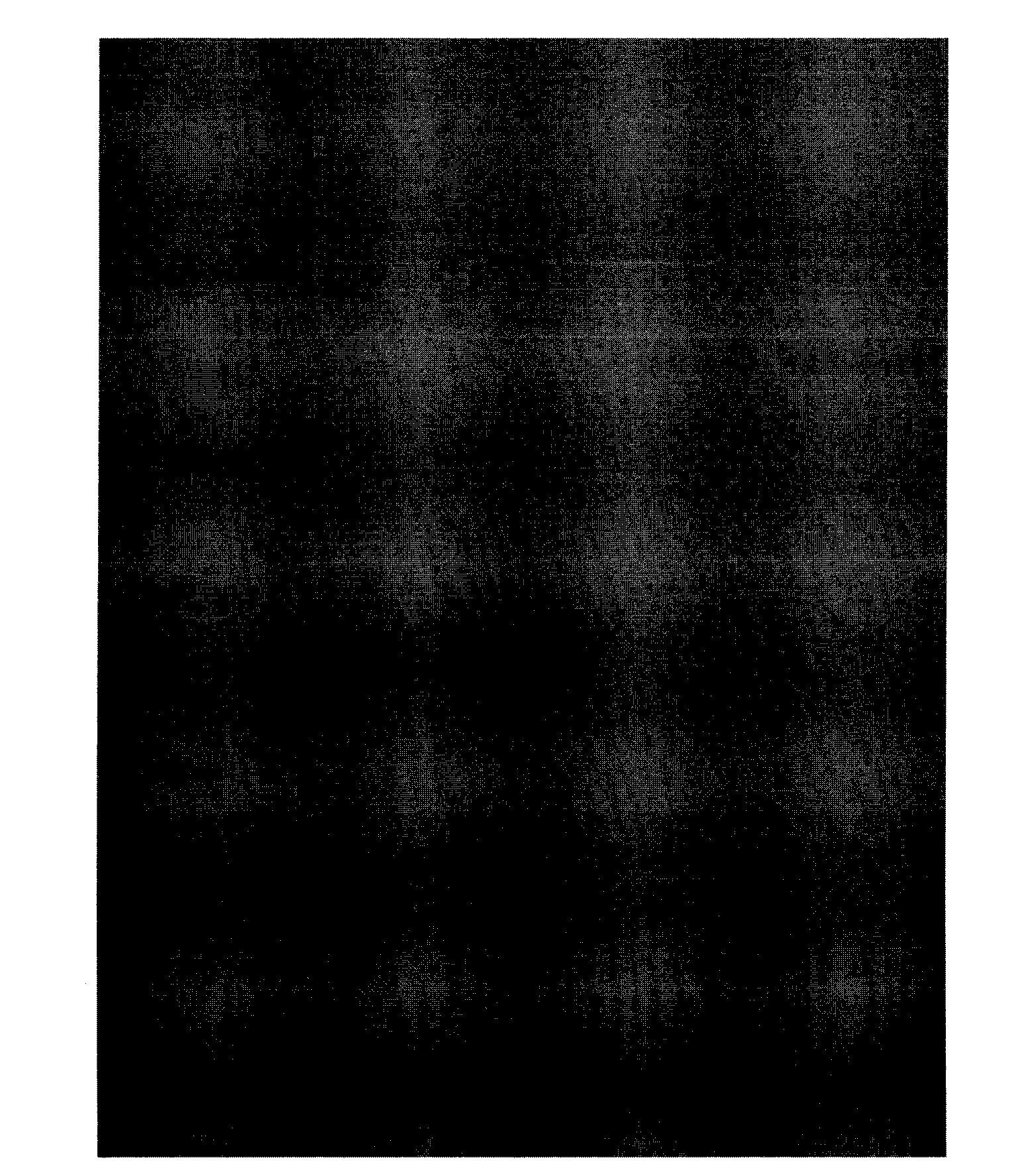 Production method of recombined human urinary trypsin inhibitor