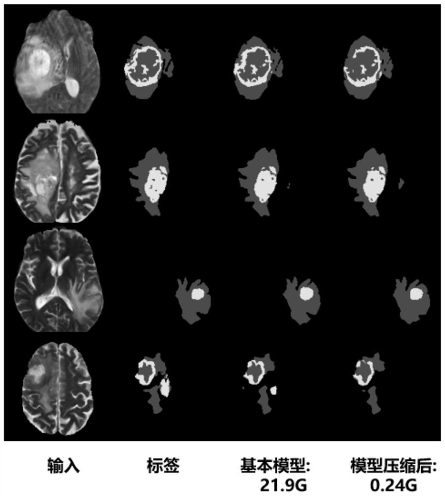 Medical image segmentation model compression method