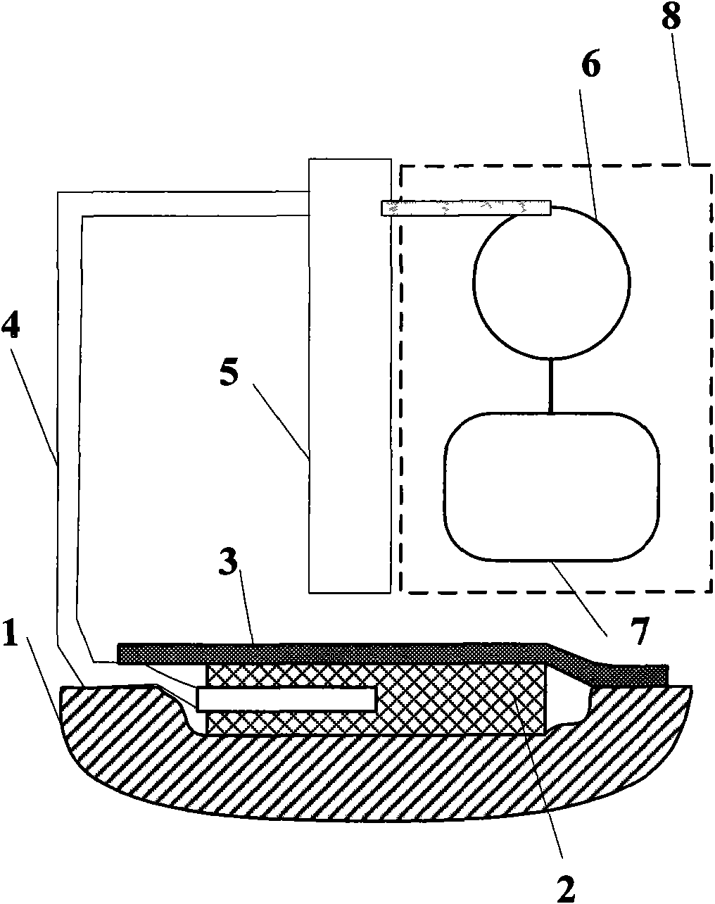 Negative pressure wound therapeutic system capable of detecting and displaying transudate volume