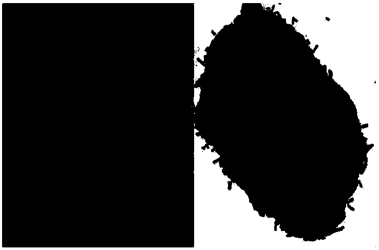 A strain of Lactobacillus crispatus and its pharmaceutical use