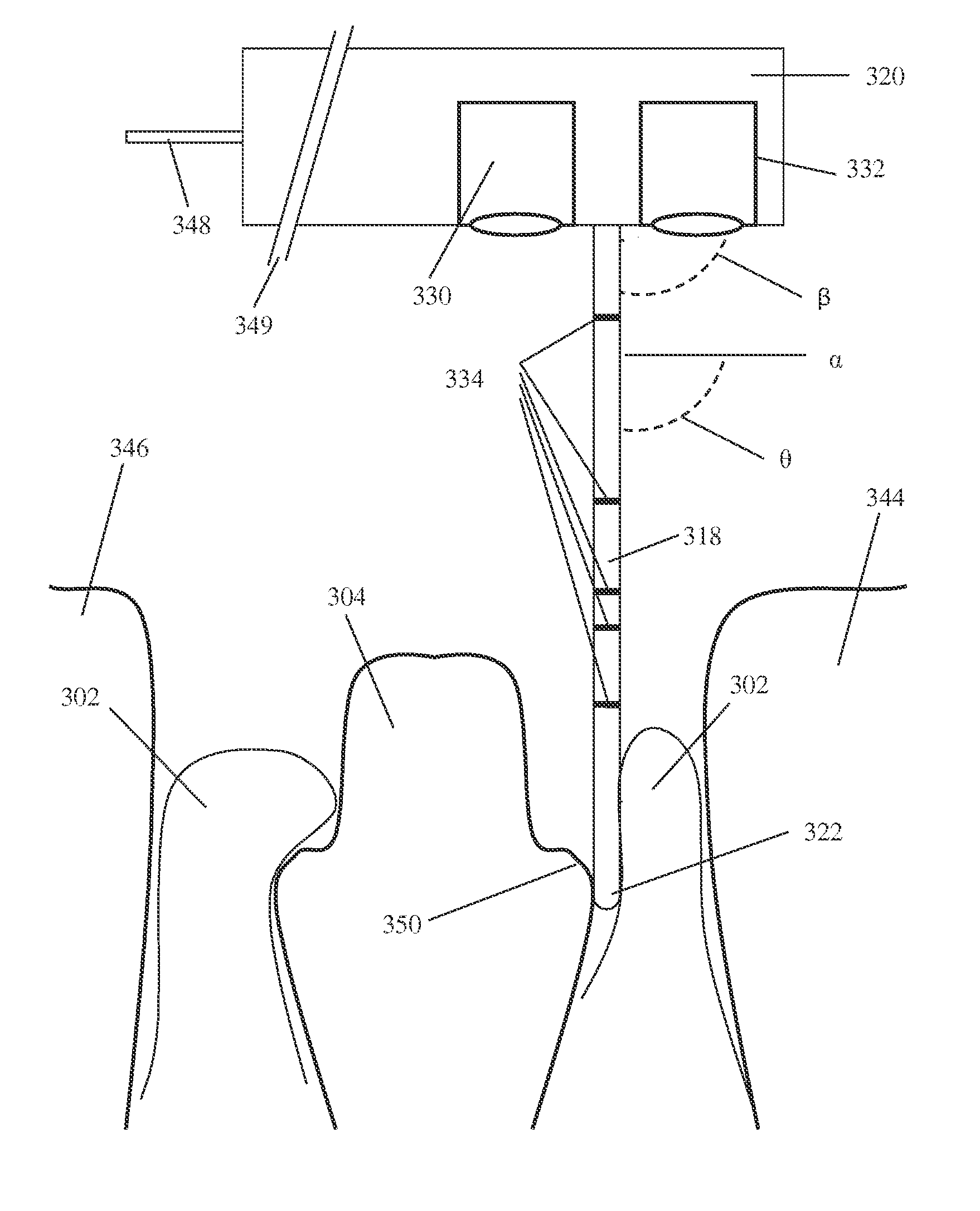 Device and method for subgingival measurement