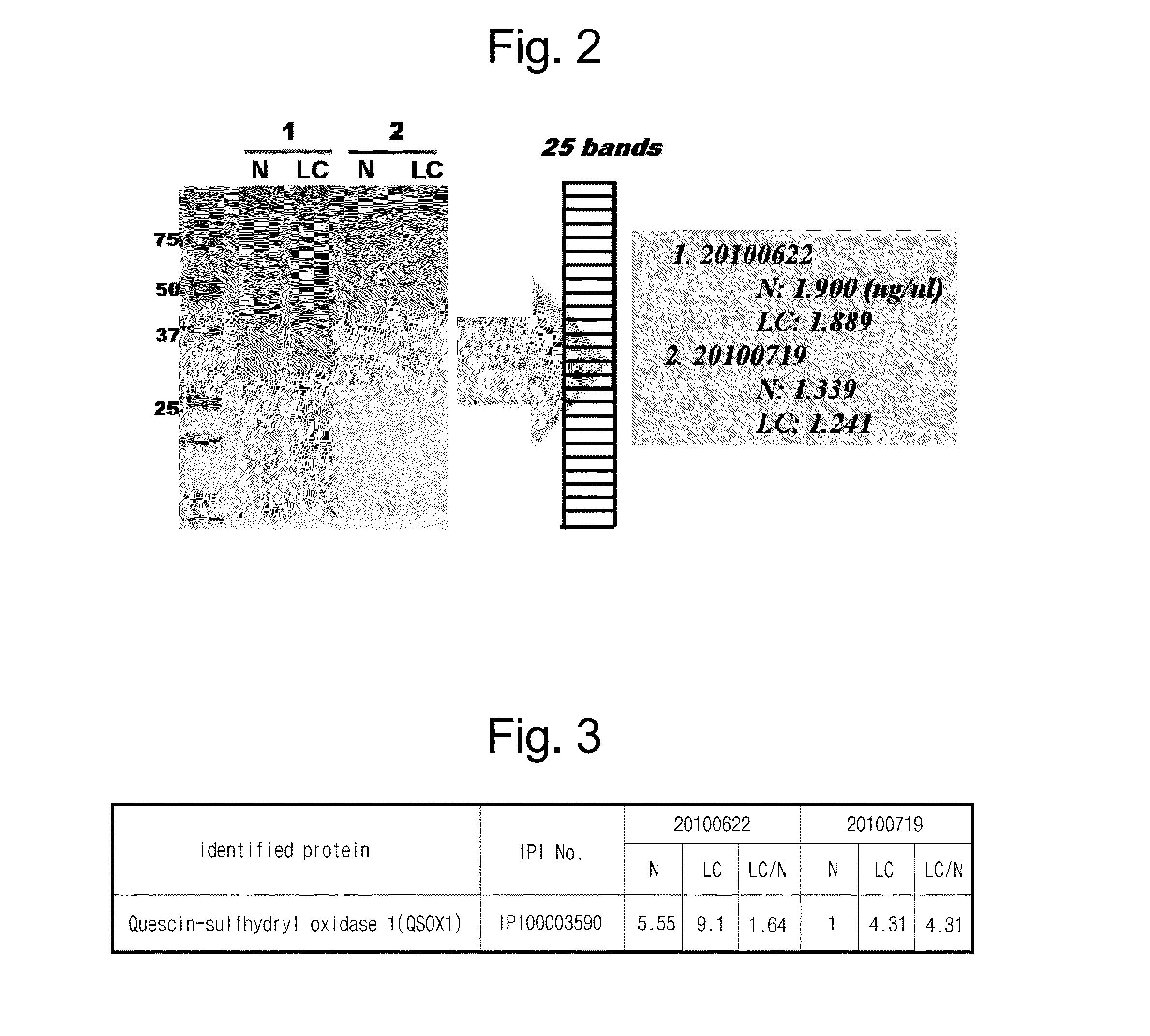 Composition for diagnosis of lung cancer and diagnosis kit of lung cancer