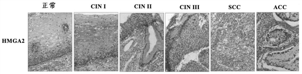 CRISPR/Lbcpf1 gene editing system and application thereof