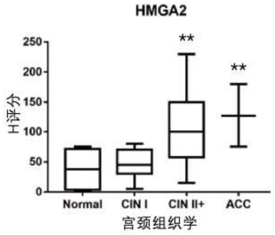 CRISPR/Lbcpf1 gene editing system and application thereof