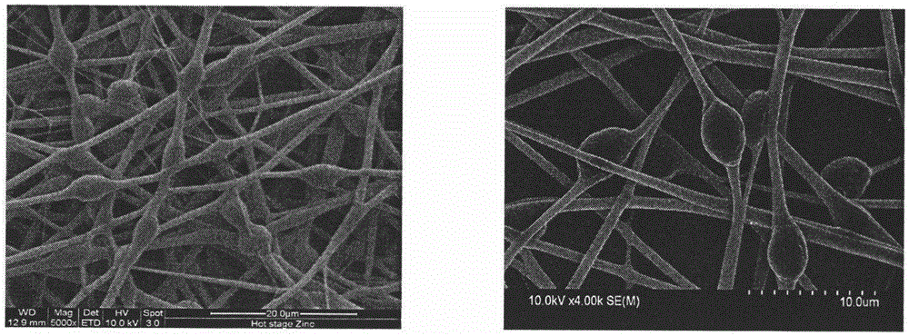 Beaded electrospun nanofiber immobilized saccharomycete and preparation method thereof