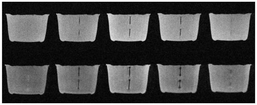 Metal implant magnetic resonance imaging method and system, terminal and storage medium