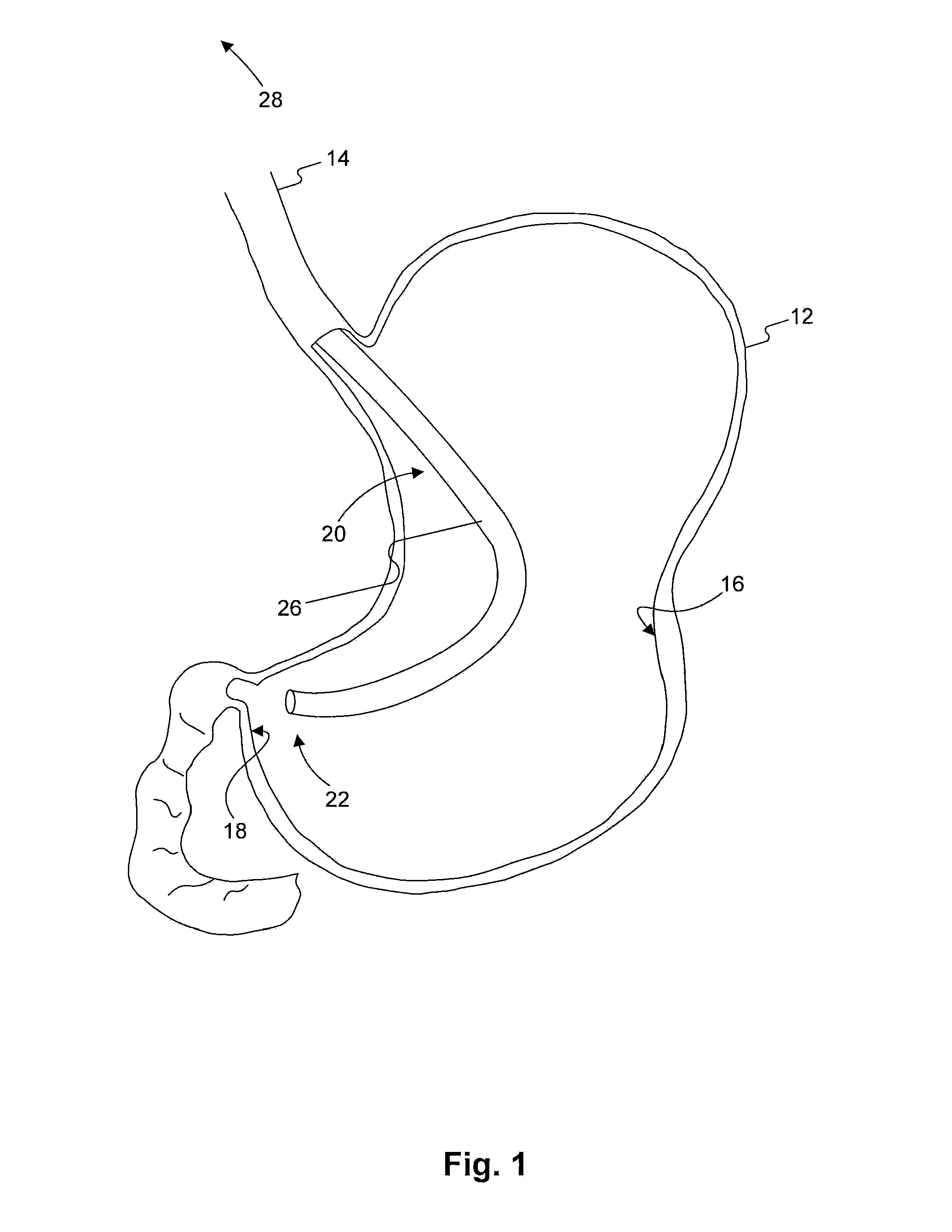 Endoscopic system for enhanced visualization