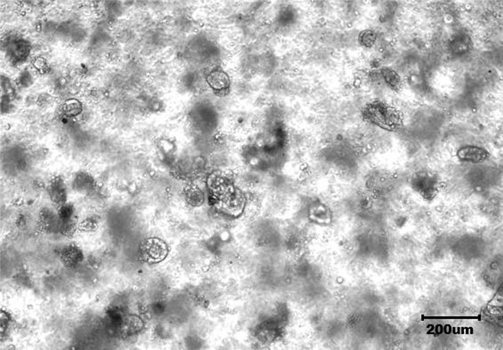 Intestinal cancer organoid culture medium, culture reagent combination and culture method