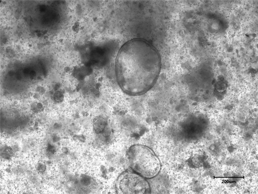 Intestinal cancer organoid culture medium, culture reagent combination and culture method