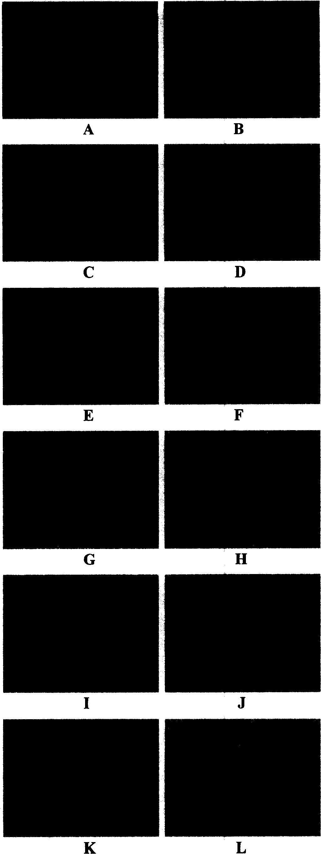 Attenuated vaccinia virus Tiantan strain vector and its preparation and application