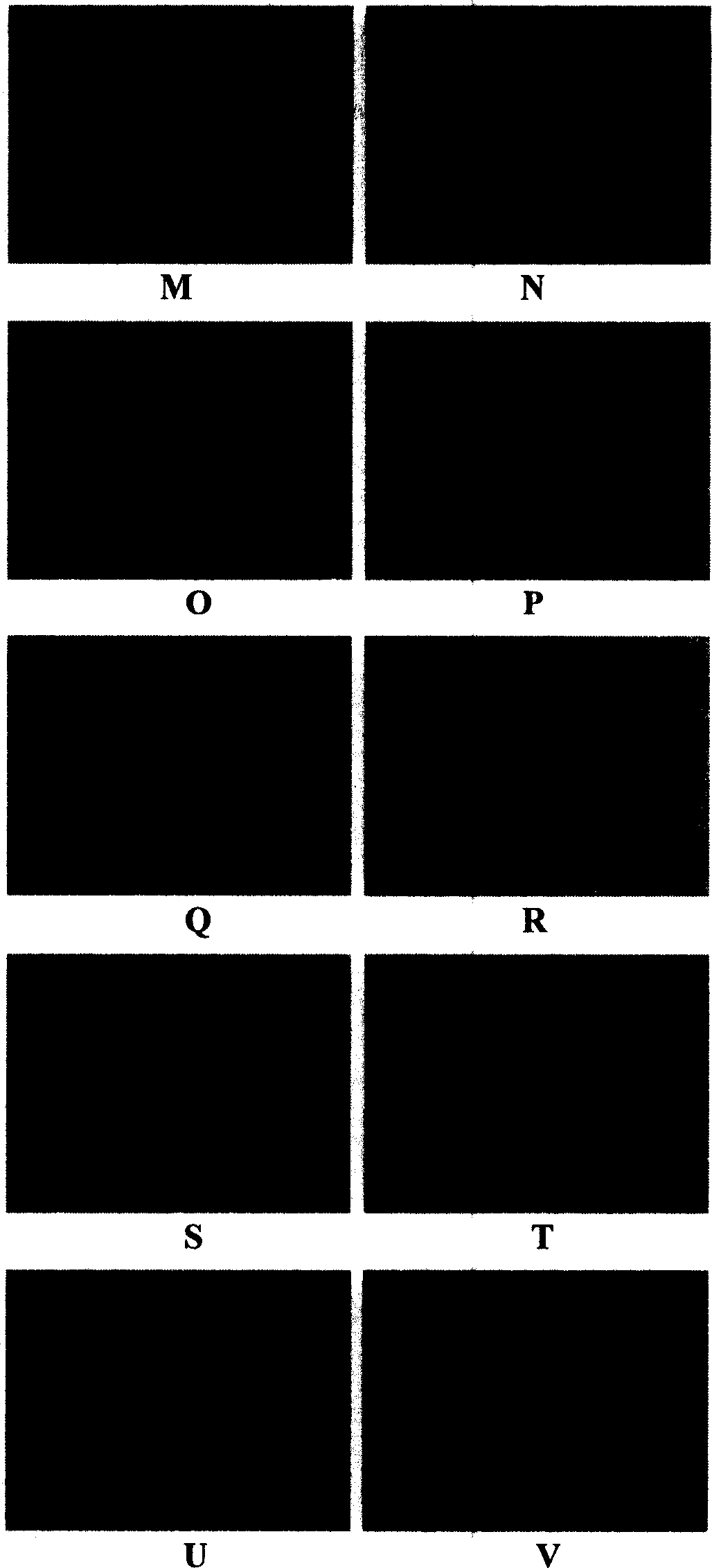 Attenuated vaccinia virus Tiantan strain vector and its preparation and application