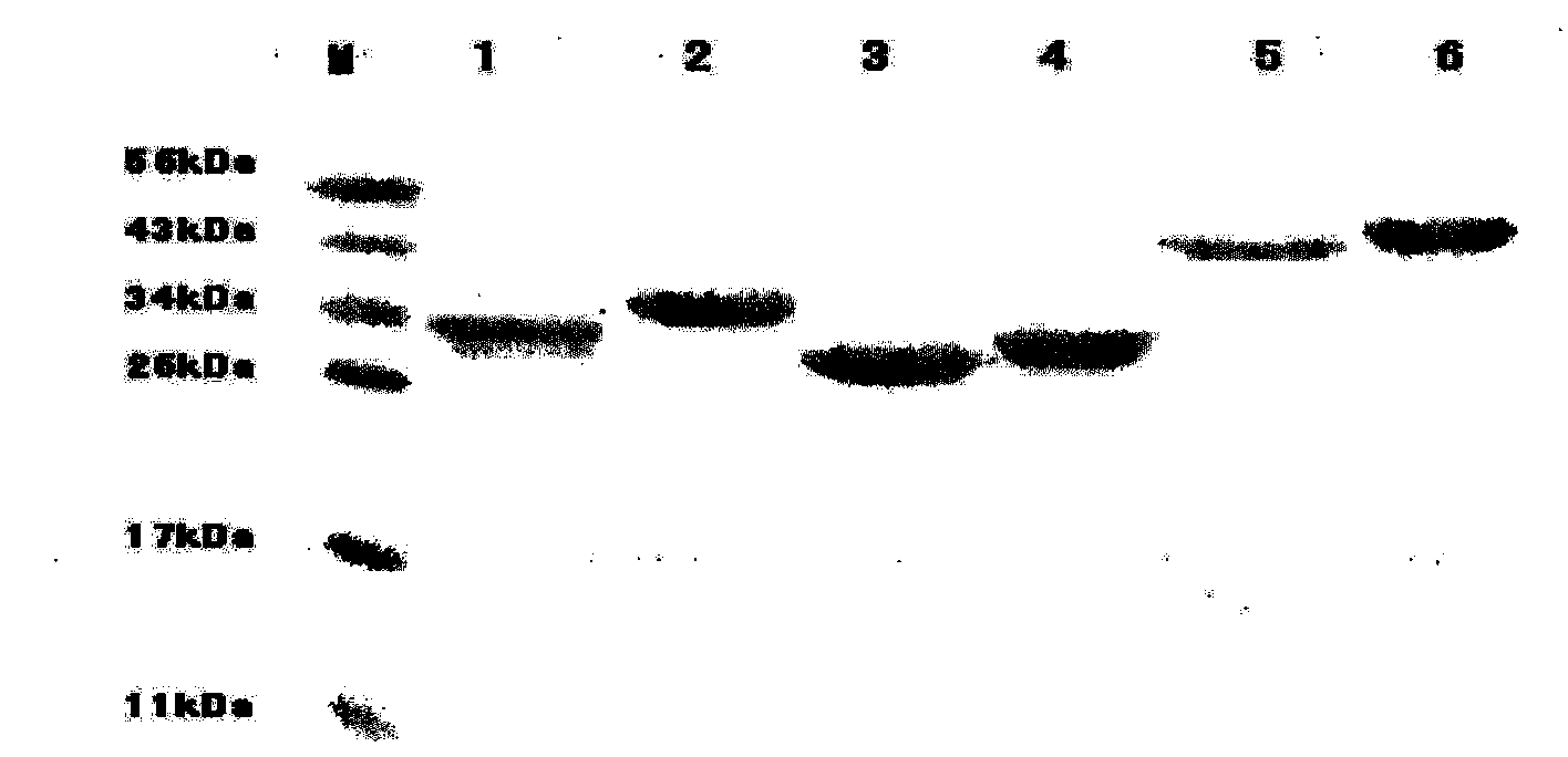 Hepatitis E virus antigen, antigen composition thereof and kit comprising antigen or antigen composition and application thereof