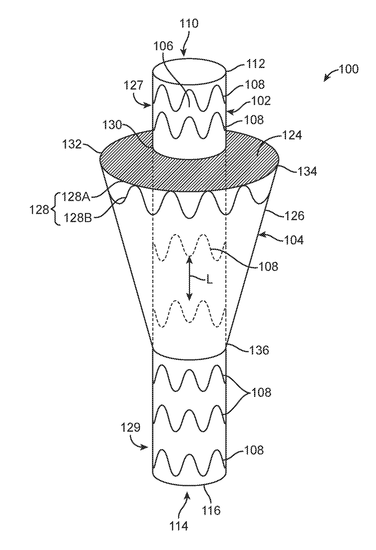 Gutter filling stent-graft and method