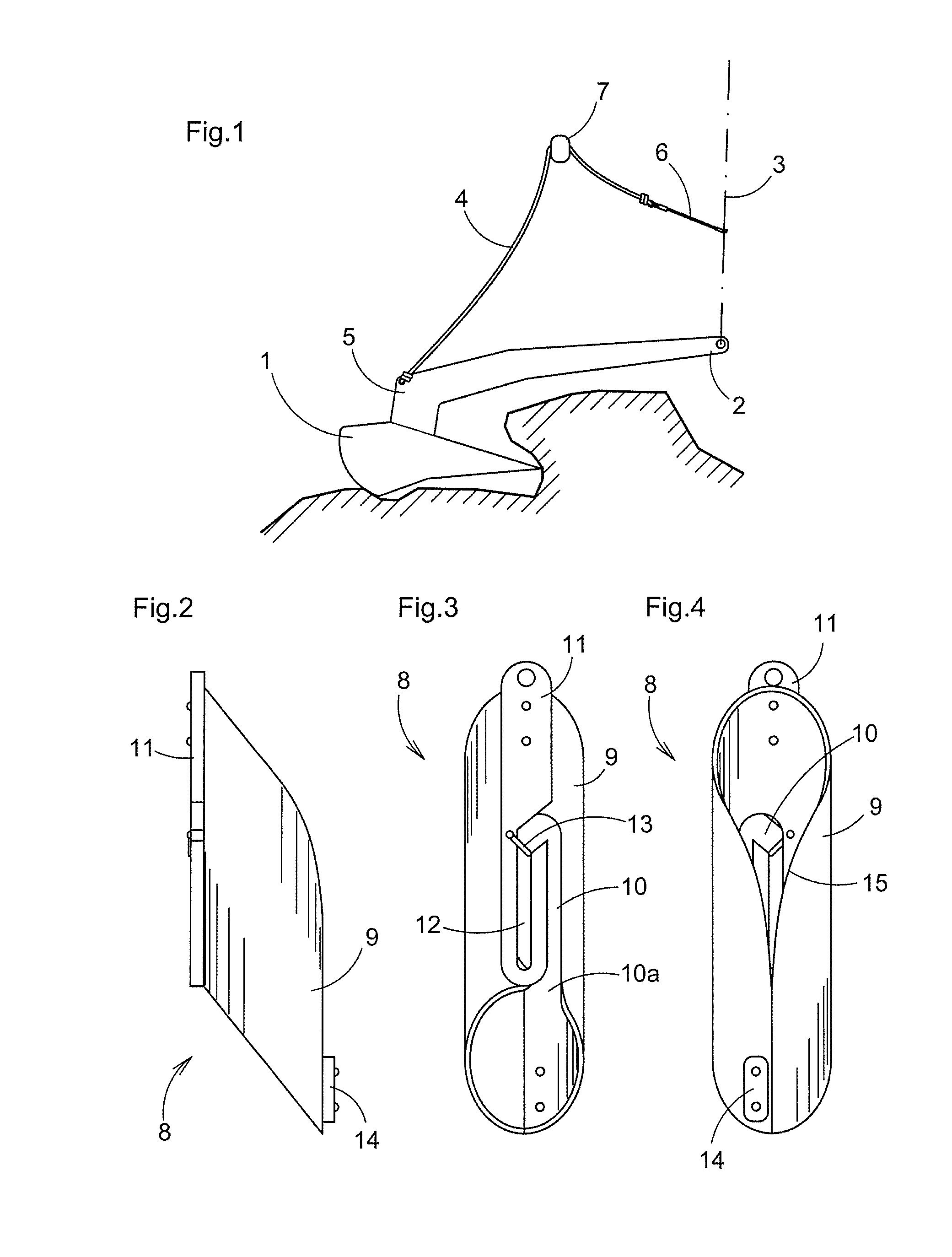 Anchor Retrieval Device