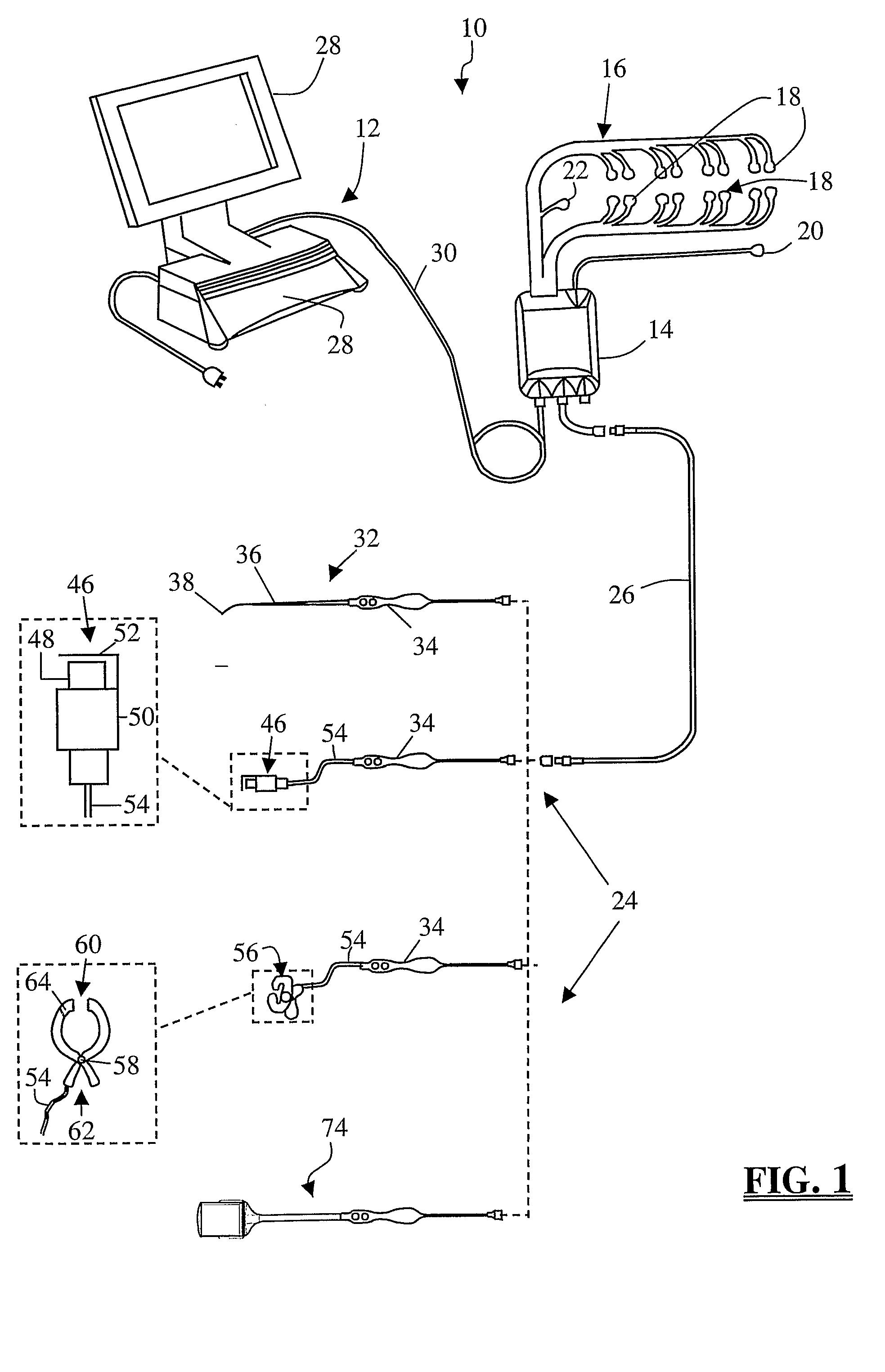 System and Methods for Monitoring During Anterior Surgery