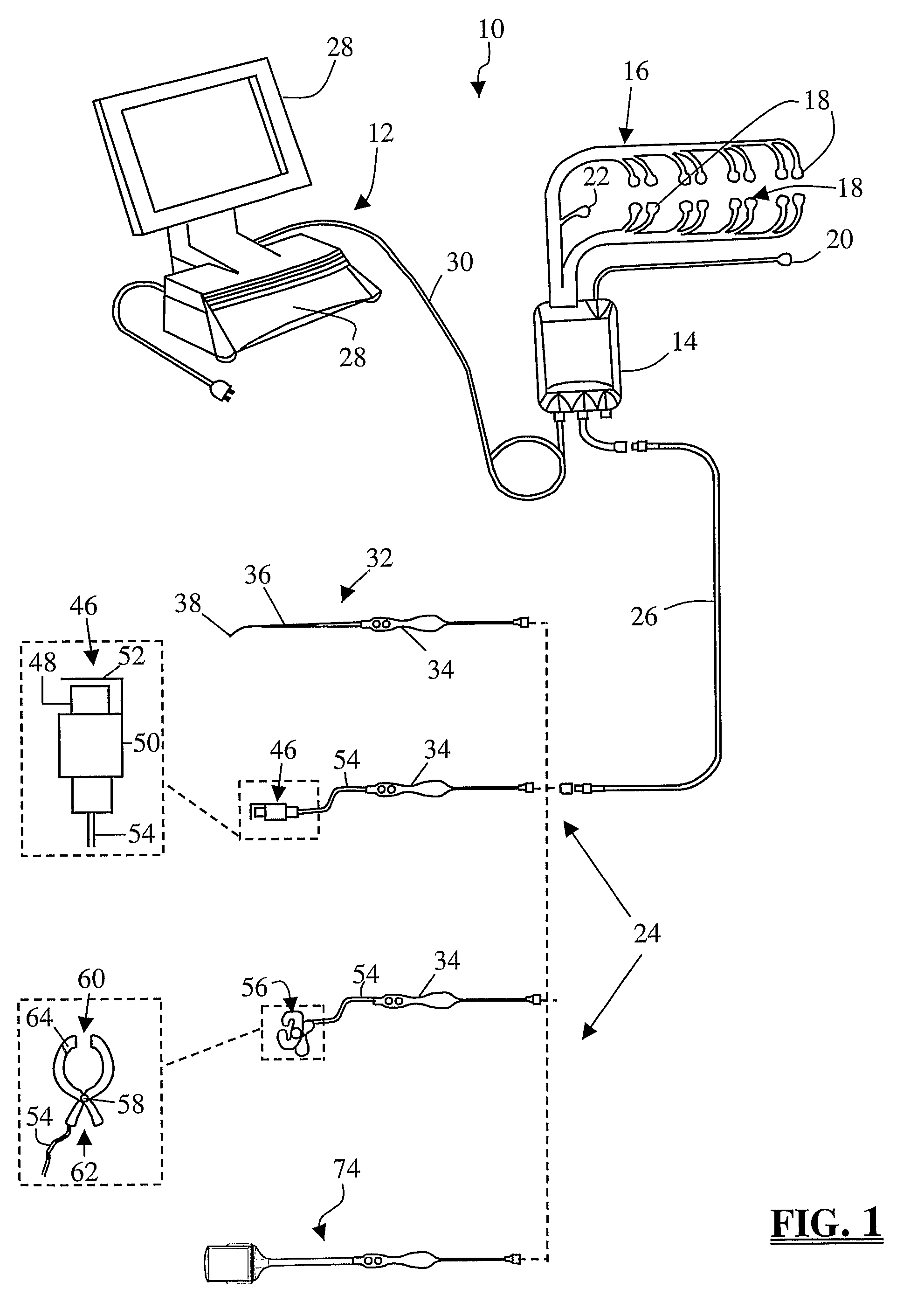 System and methods for monitoring during anterior surgery