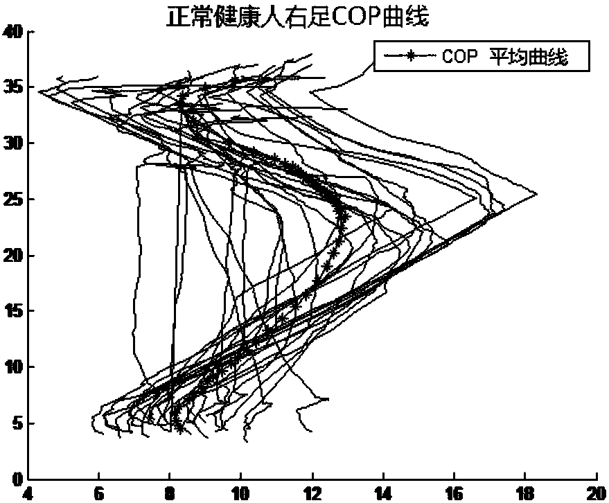 Analysis method for gait characteristics after anterior cruciate ligament rupture