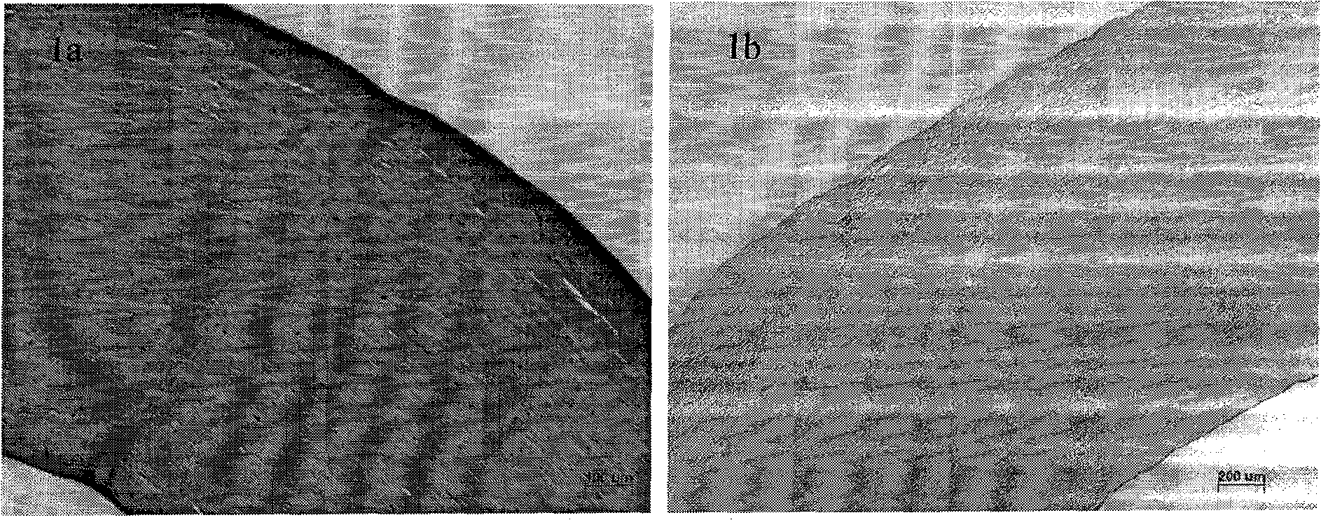 Method for preparing acellular matrix