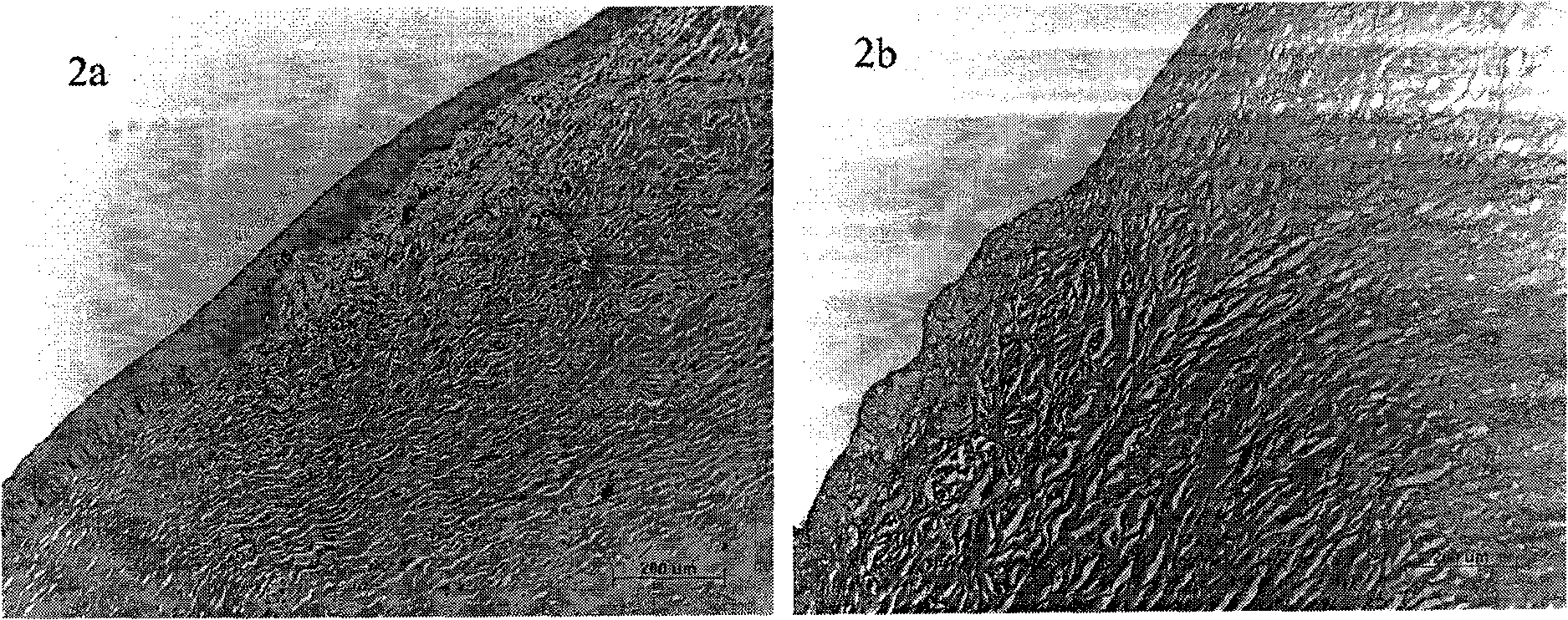 Method for preparing acellular matrix