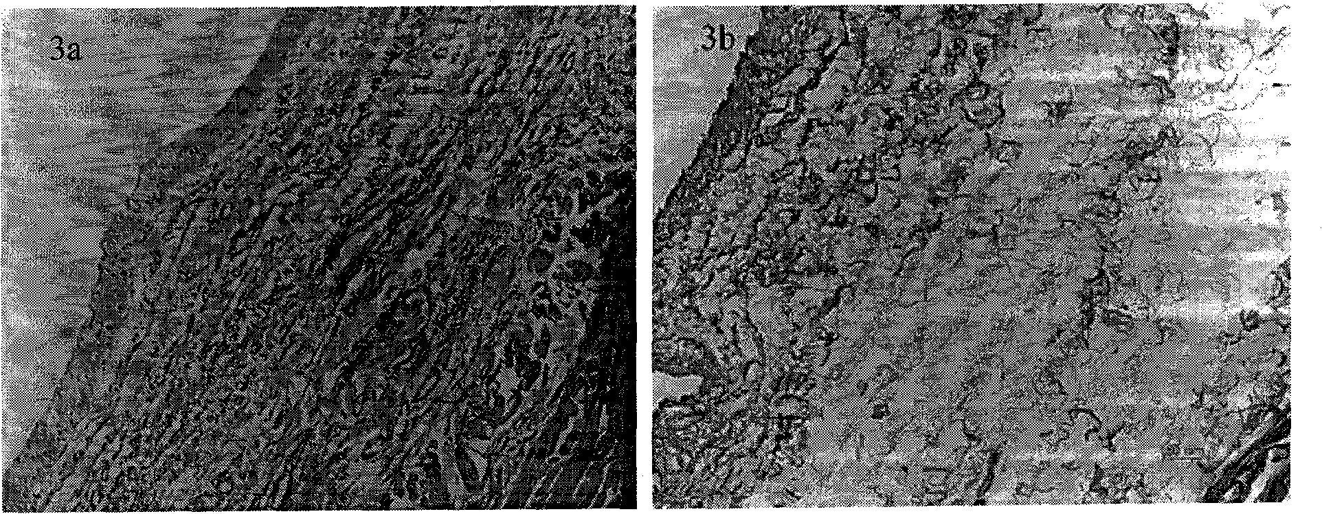 Method for preparing acellular matrix