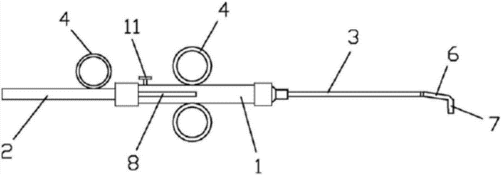 Medicine carrying device for treating salpingostenochoria