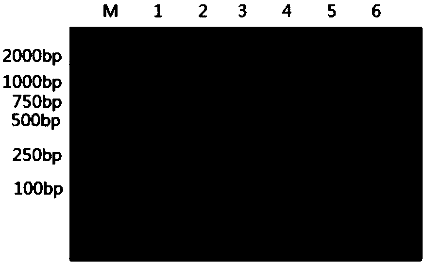 RPA primer for detecting transgenic corn Bt11 strain and detecting method