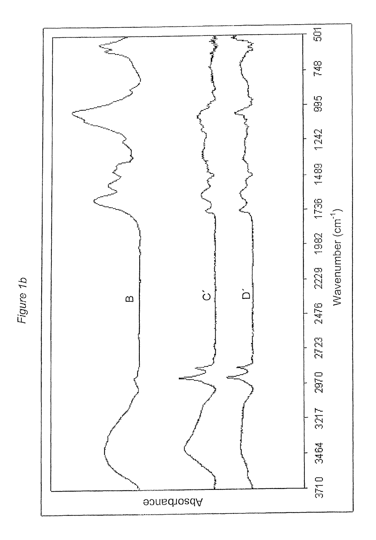 Detection and removal of carious dentin tissue