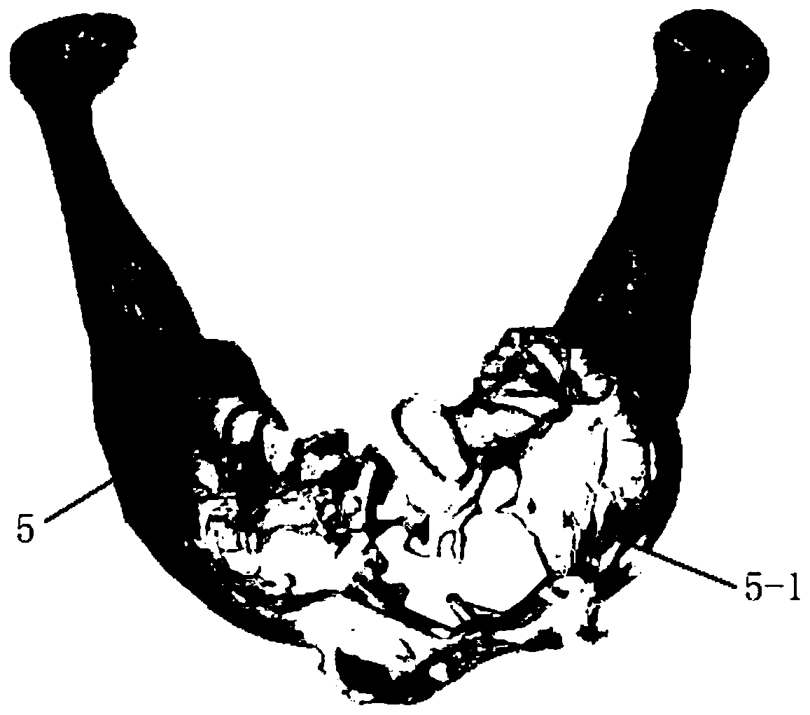 Mandible body bone movement kit based on mandible three-dimensional database matching and preparation method thereof