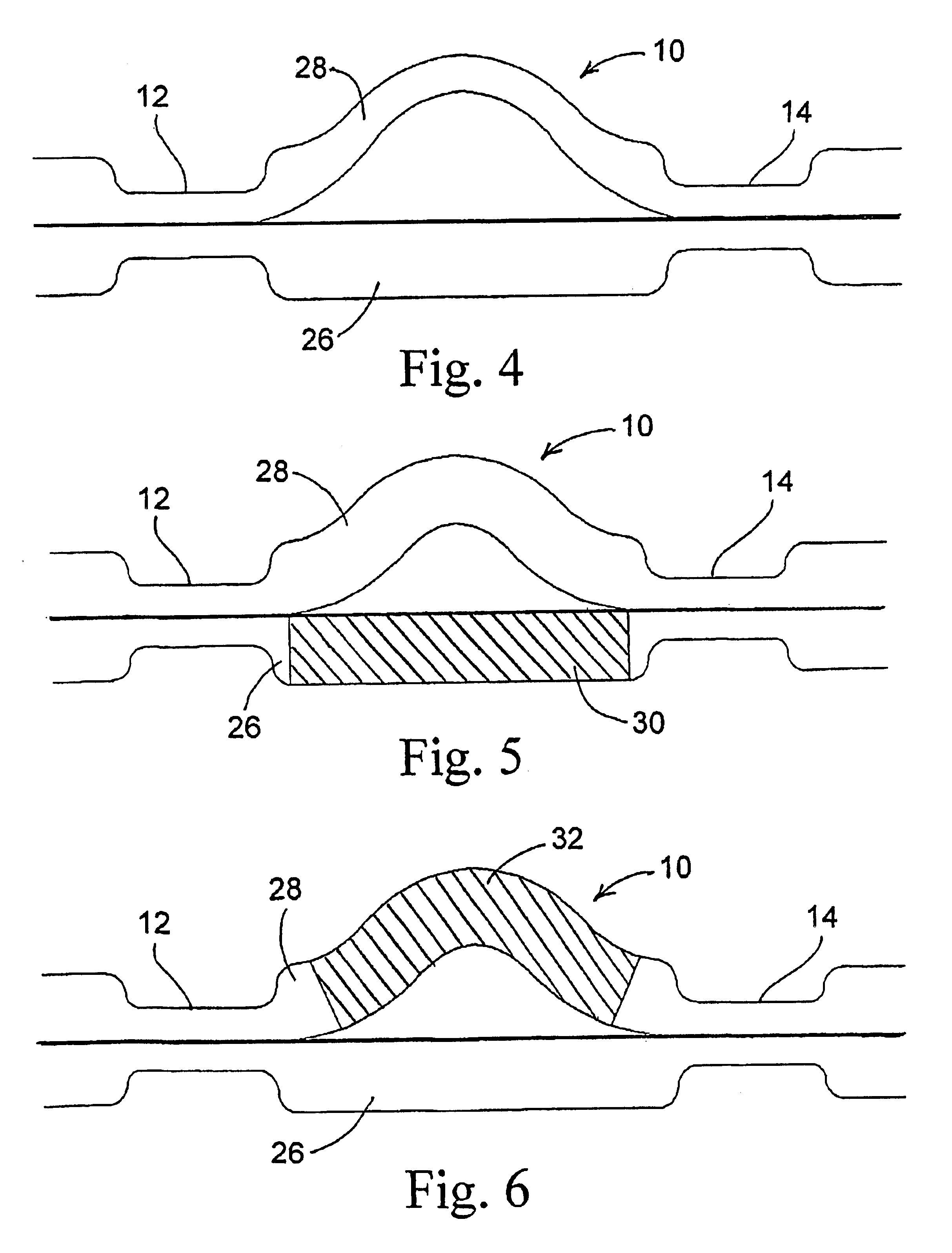 Passive thermal compensation of all-fiber Mach-Zehnder interferometer