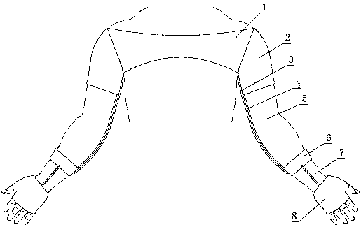 Device for correcting varus and valgus deformity of elbow joints