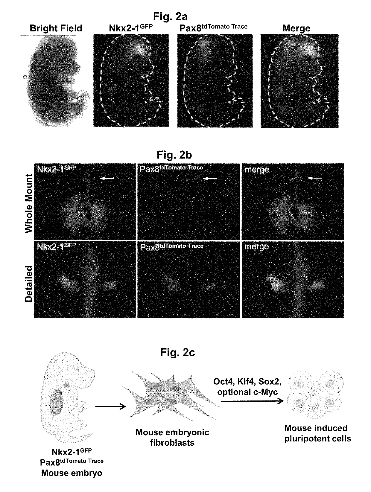 Differentiation of stem cells into thyroid tissue