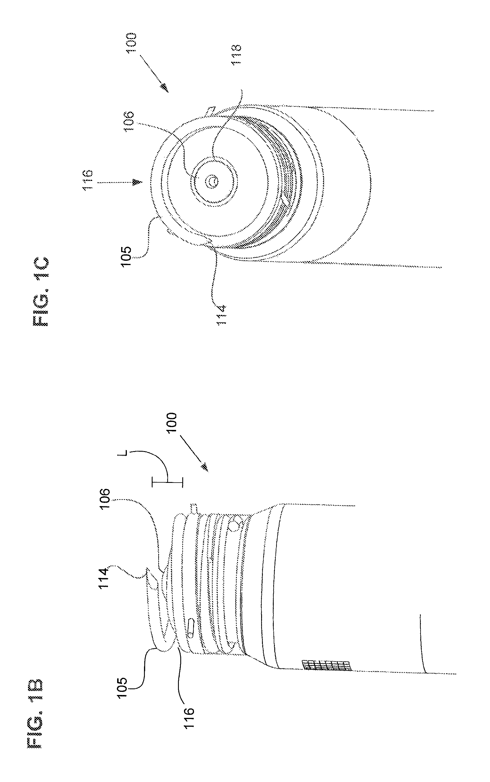 Leadless pacemaker with radial fixation mechanism