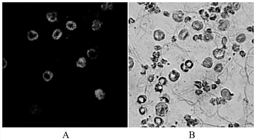 Antibody for detecting infectious spleen and kidney necrosis virus and its preparation and application