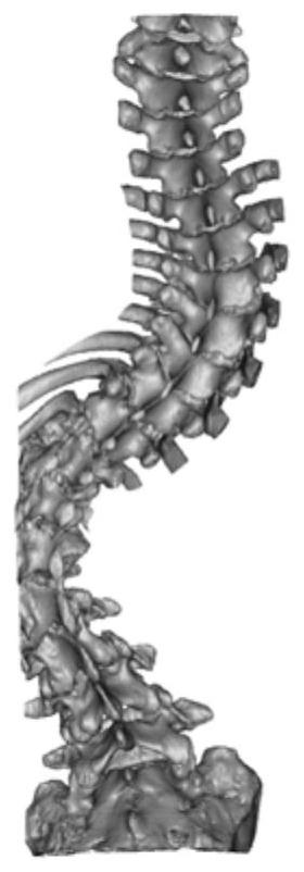 3D printing method for large-size complex-structure bone tissue