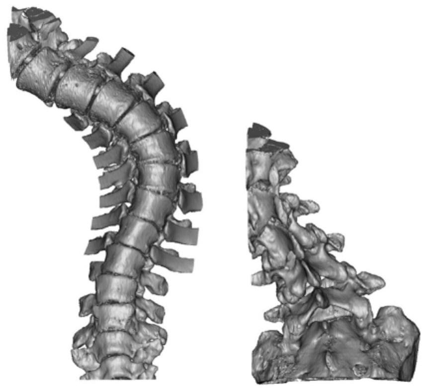 3D printing method for large-size complex-structure bone tissue