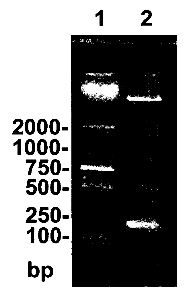 Method for preparing procalcitonin antibody